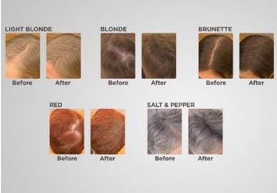 Joan Rivers Great Hair Day Root Touch Up Powder Duo - Fill-in Powder for Thicker, Fuller Looking Hair (Blonde)