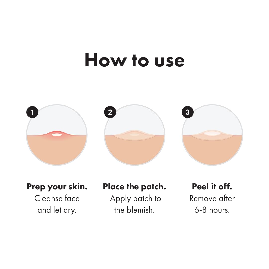 Mighty Patch™ Invisible+ Daytime Hydrocolloid Acne Patch – Covers Zits & Blemishes, Skin-Blending Tapered Edges, 72ct