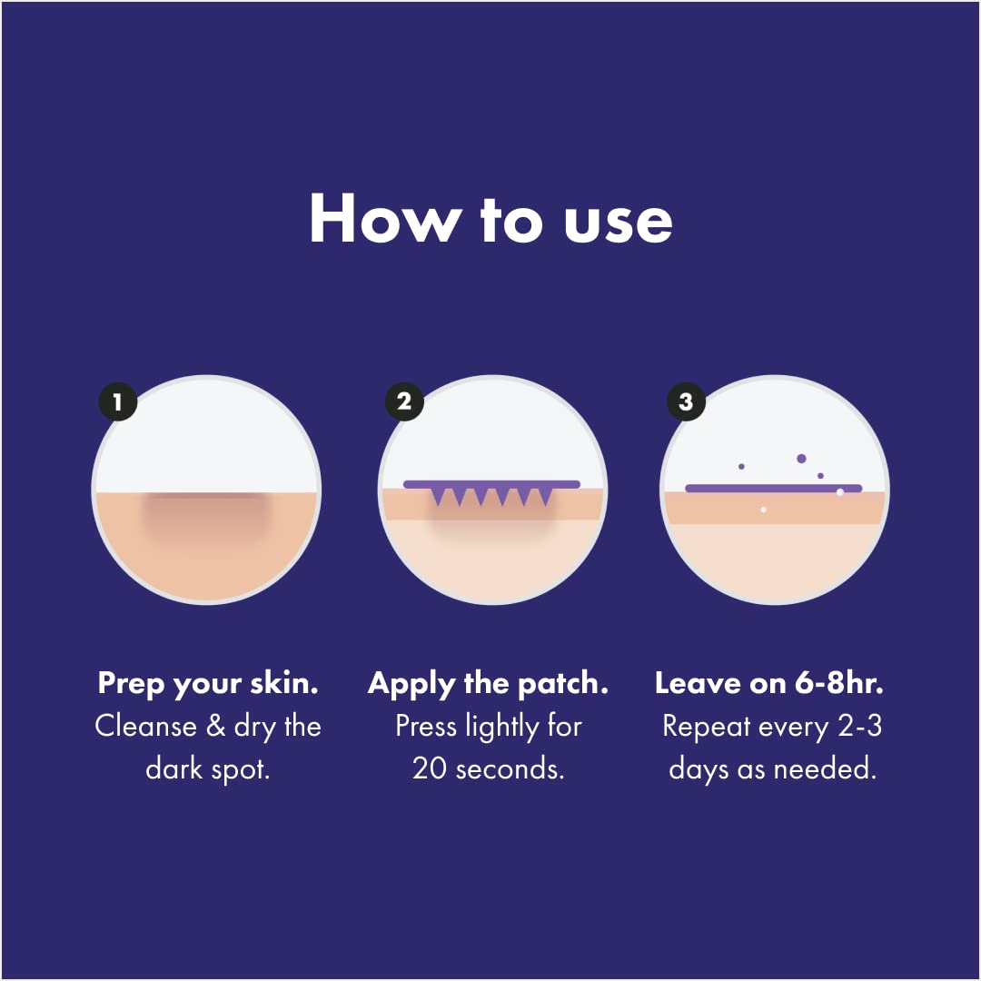 Hero Cosmetics Mighty Patch Micropoint™ Dark Spot Treatment – 8 Count Post-Blemish Patches, 395 Micropoints, Dermatologist Tested & Gentle