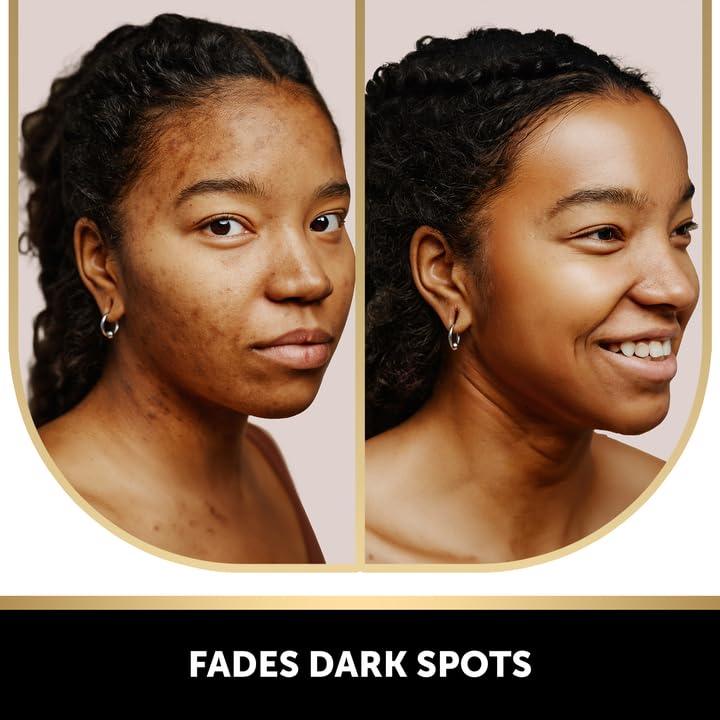 VALITIC Kojic Acid Dark Spot Soap with Turmeric, Vitamin C & Retinol – Japanese Complex, Hyaluronic Acid, Shea Butter, 3-Pack