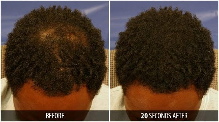 Dr. Yates MD Keratin Fiber Hair Enhancer (Dark Blonde)