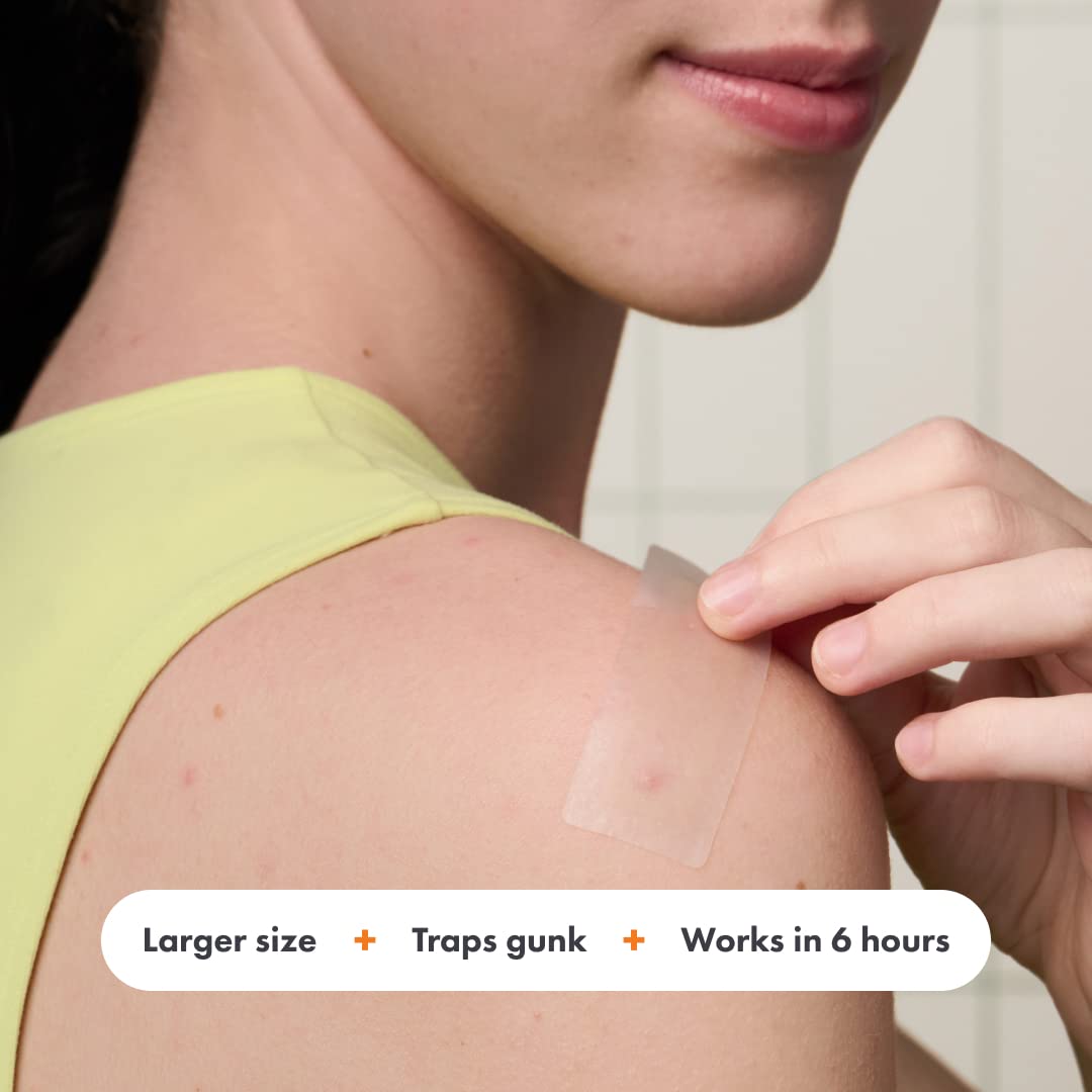 Hero Cosmetics Mighty Patch Surface Large Pimple Patches – Acne Spot Stickers for Face & Body, Hydrocolloid, Vegan, 10 Count