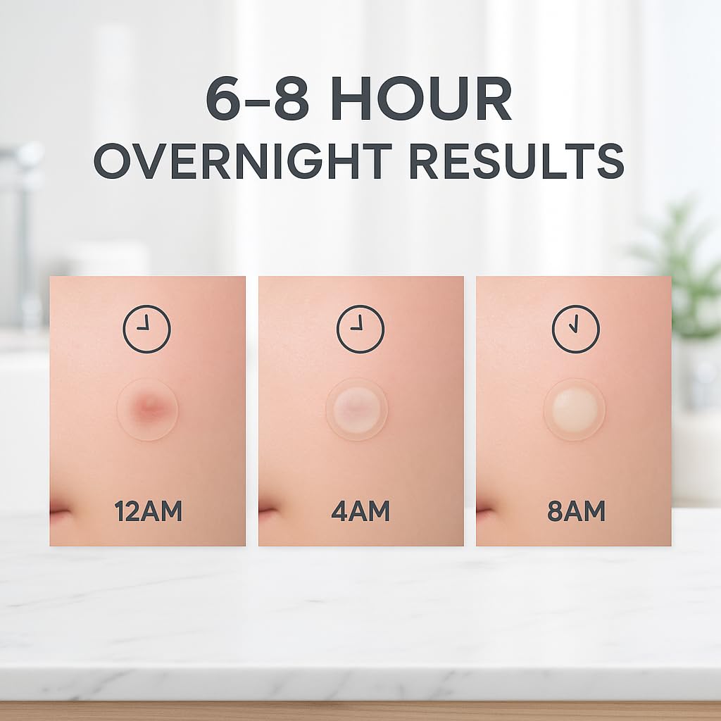 LE GUSHE Korean Pimple Patches 132 Dots - Hydrocolloid Acne Stickers with Tea Tree Oil, Invisible, Dermatologist Tested Skincare