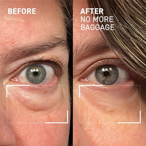 Dr. Brandt Needles No More, No More Baggage - Minimizes Under-Eye Bags, Puffiness & Dark Circles - 0.5 oz