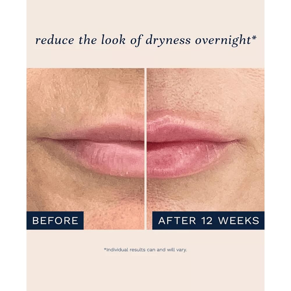 City Beauty City Lips Night Oil – Plumping, Hydrating & Restoring Overnight Lip Treatment with Hyaluronic Acid & Plant Extracts