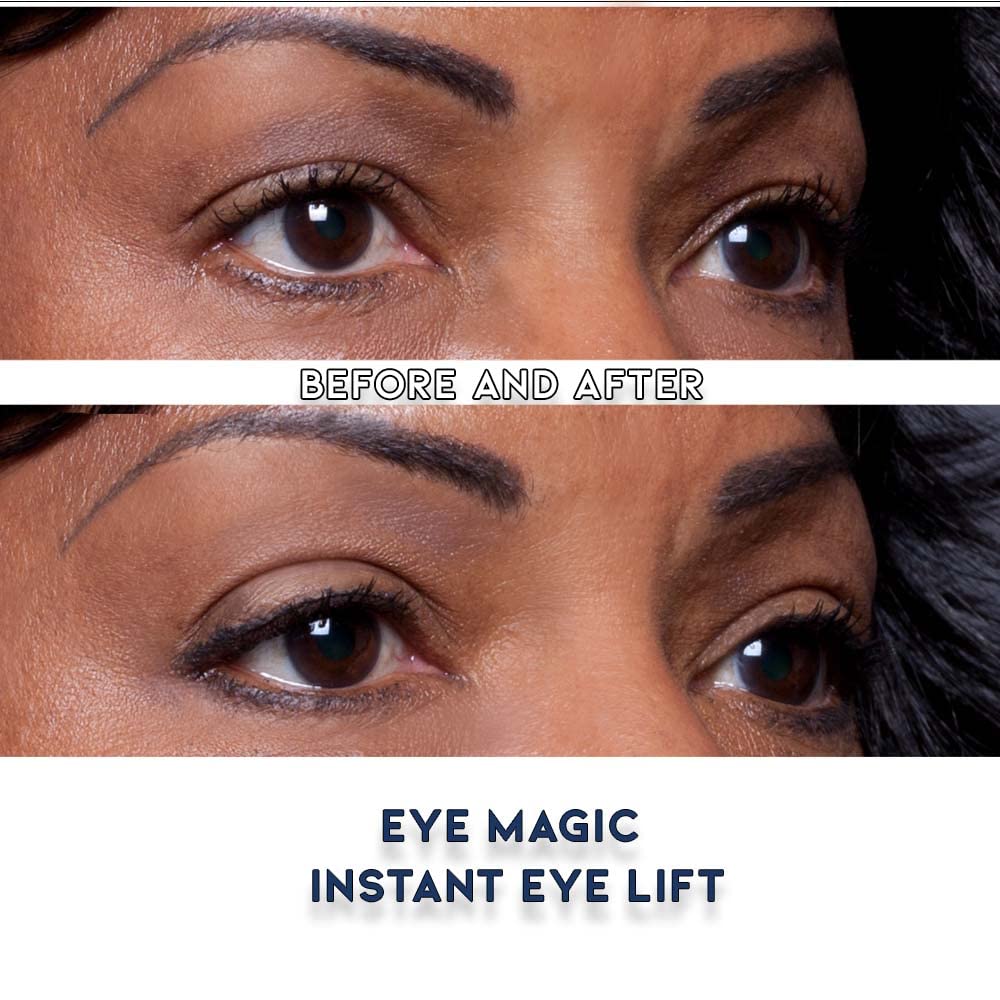 Eye Magic Premium Eye Lift Strips for Droopy or Hooded Eyelids, Instant Non-Surgical Tape, Hypoallergenic, Transparent, 80ct S/M