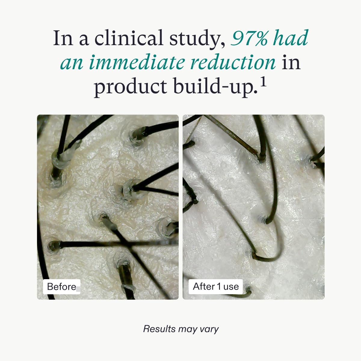 Nutrafol Exfoliating Scalp Mask - Removes Build-up & Excess Oil for Healthier Scalp, Physician-Formulated for Thinning Hair, Color & Extension Safe, 4 Fl Oz