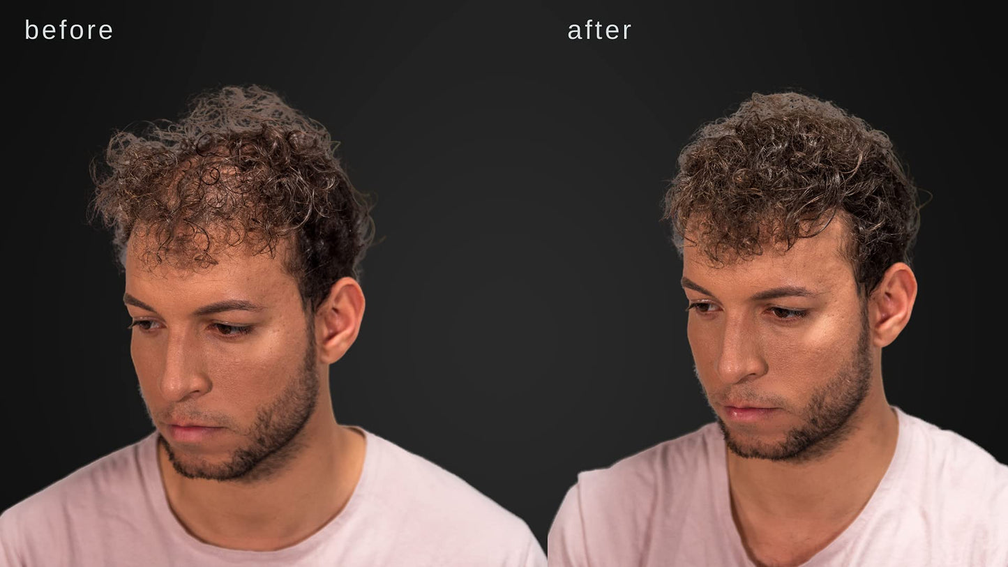 LUXE Hair Building Fibers for Thinning Hair – Dark Brown – Thickening Fibers, Hypoallergenic, Dermatologist Tested, 2+ Month Supply