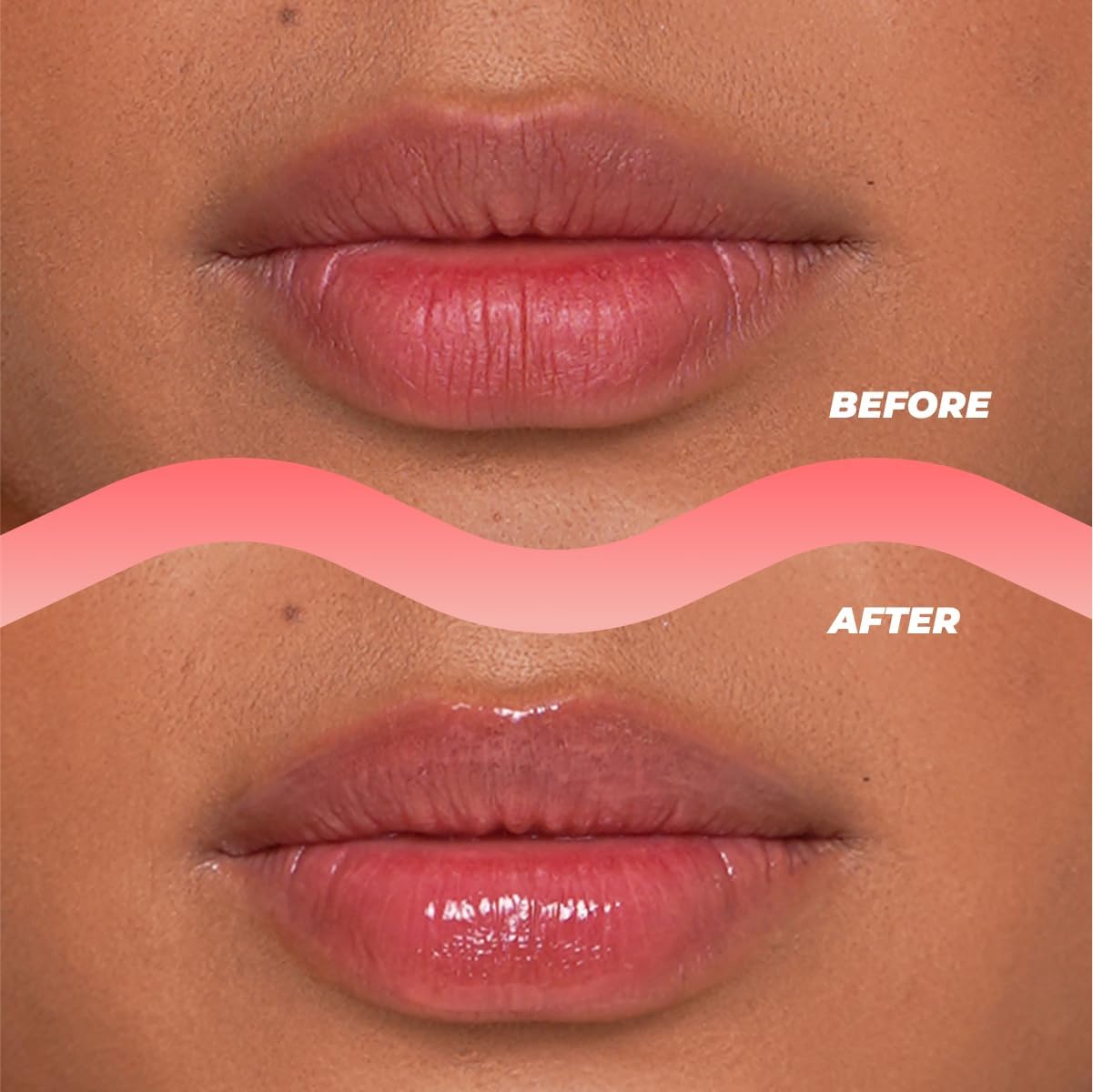 Vitamasques Watermelon Lip Sugar Scrub – Exfoliates, Moisturizes & Softens Lips with Shea Butter, Overnight Hydration, Made in Korea