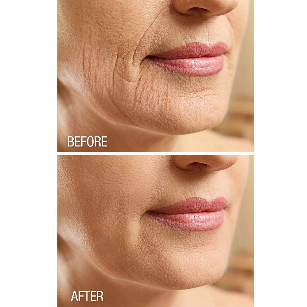 Dermactin-TS Crepe Be Gone Body Souffle 3 ounce (2-Pack)