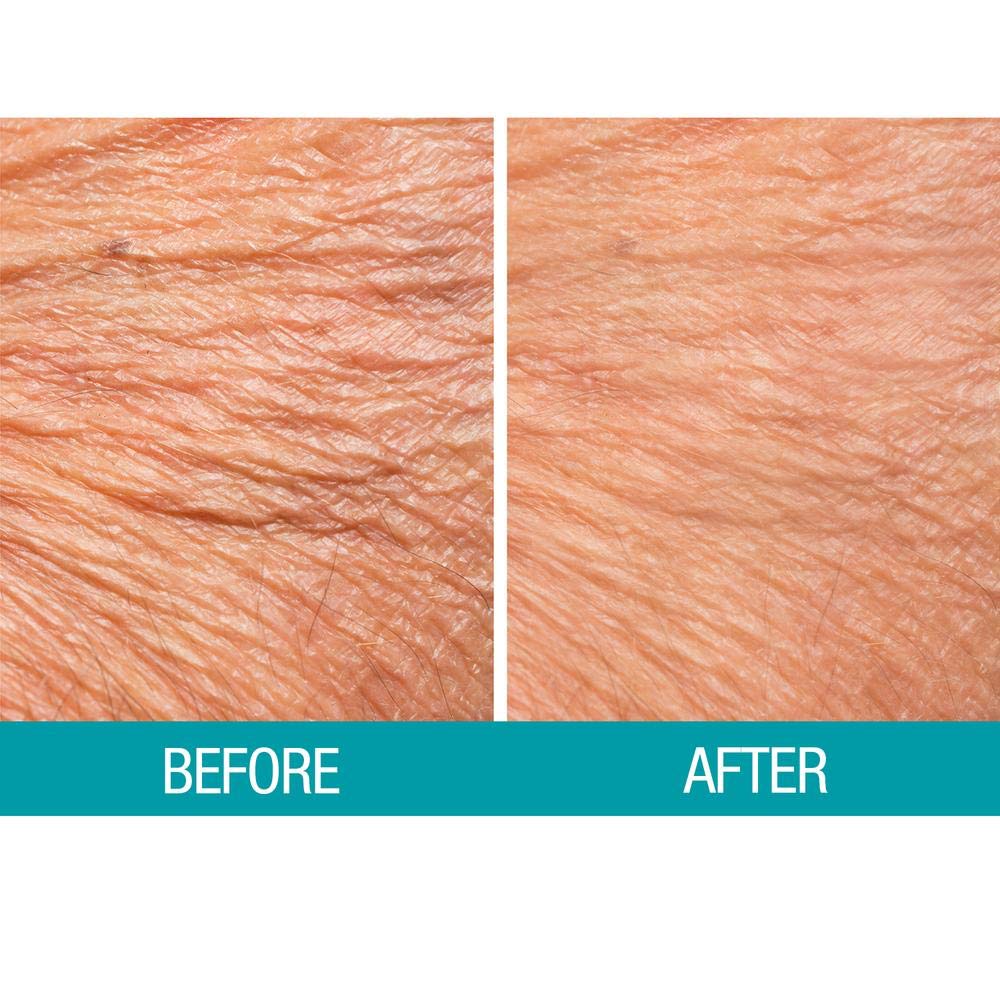 Dermactin-TS Crepe Be Gone Body Souffle 3 ounce (2-Pack)