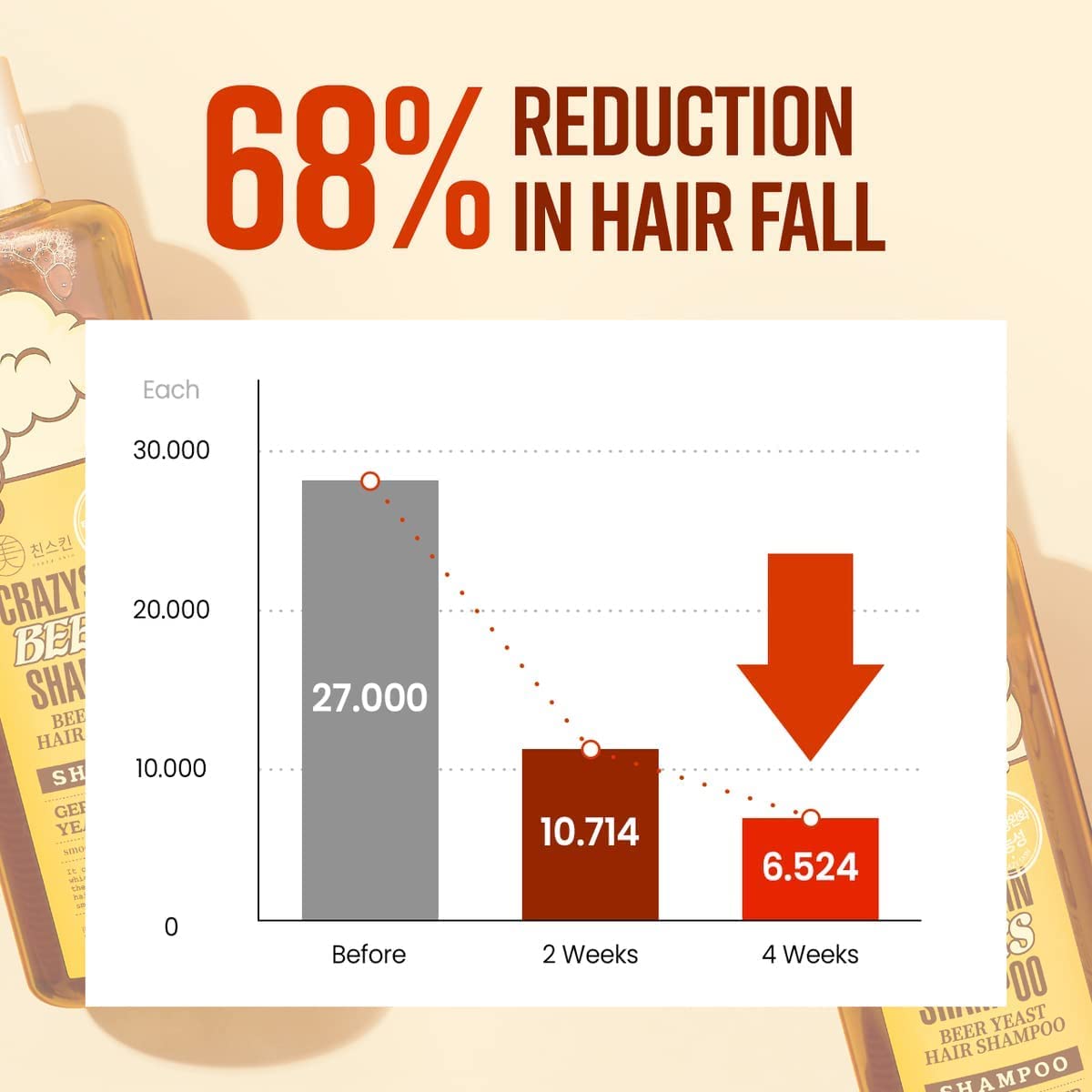 CRAZY SKIN German Beer Yeast Biotin Shampoo 300ml – Anti-Hair Loss, Thickening, Hard Water Defense, Gentle Exfoliating, Sulfate-Free Formula