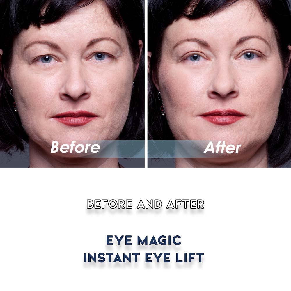 Eye Magic Premium Eye Lift Strips for Droopy or Hooded Eyelids, Instant Non-Surgical Tape, Hypoallergenic, Transparent, 80ct S/M