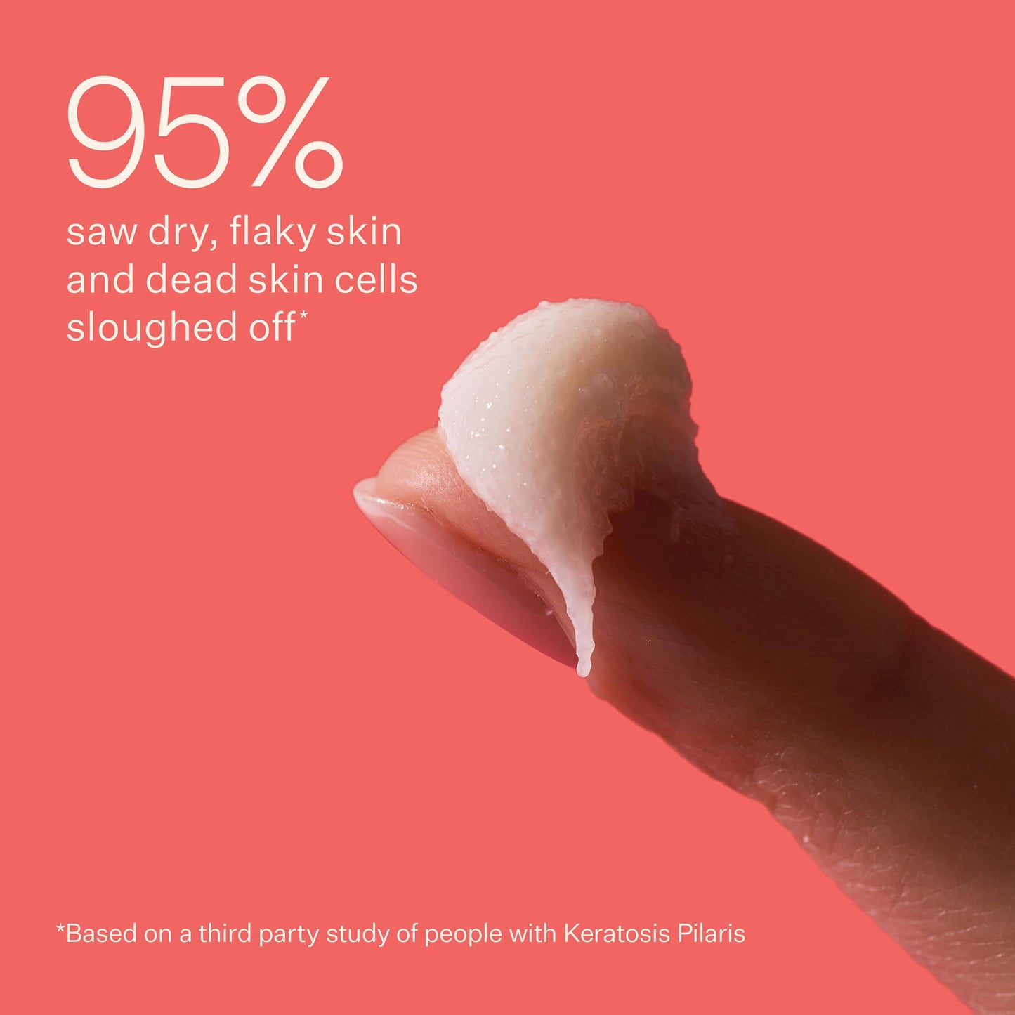 Peach & Lily KP Bump Boss Microderm Body Scrub, 10% AHA (Glycolic & Lactic Acid) | Smooth, Radiant Skin | Clean & Cruelty-Free 8.11oz