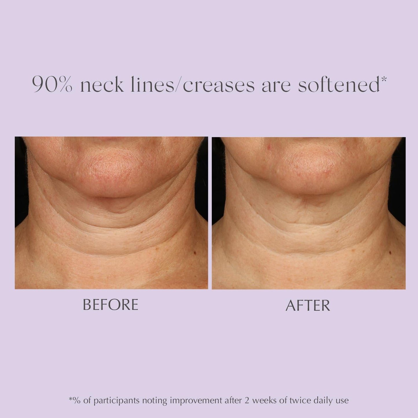 EXUVIANCE AGE REVERSE+ Neck Cream – Firms, Smooths Wrinkles, Evens Tone, Anti-Aging Décolletage Moisturizer with Peptides & Bakuchiol, 4.4 oz