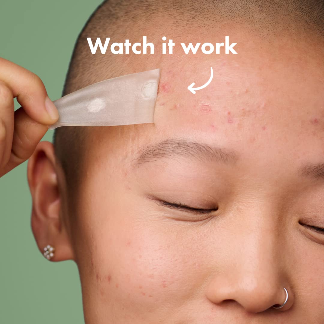 Hero Cosmetics Mighty Patch Surface Large Pimple Patches – Acne Spot Stickers for Face & Body, Hydrocolloid, Vegan, 10 Count