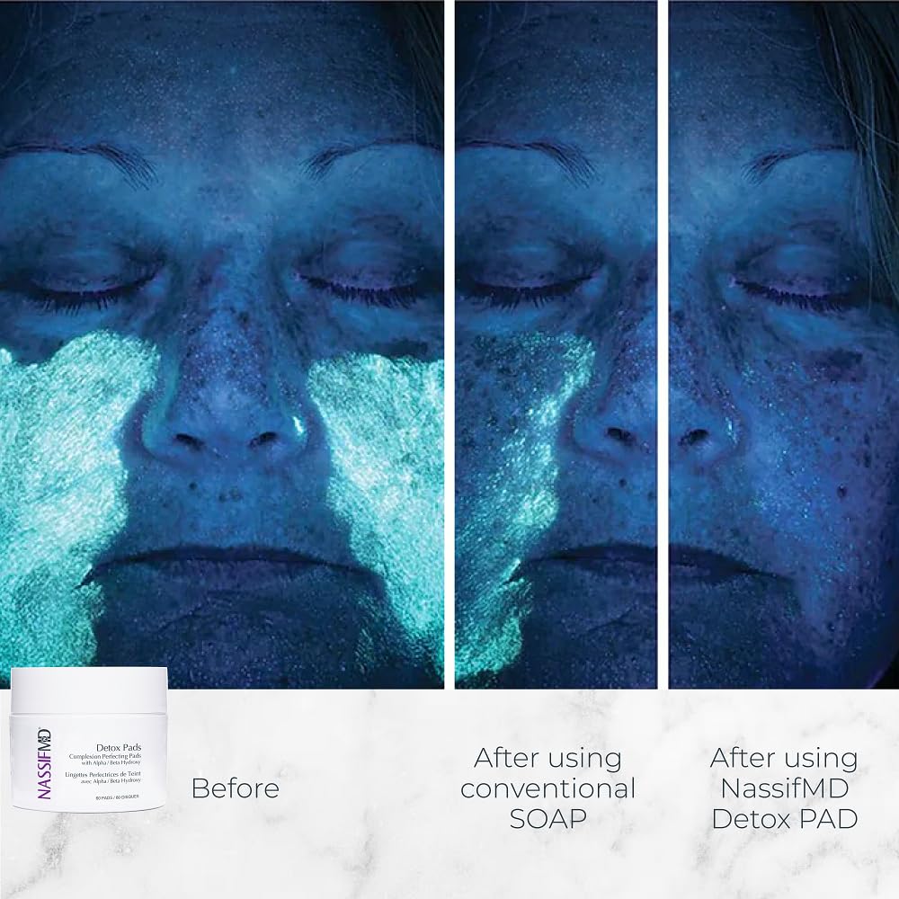 NassifMD Exfoliating Detox Pads – AHA/BHA Facial Pads for Deep Cleansing, Smooth Texture, Pore Reduction, Firming & Radiant Skin