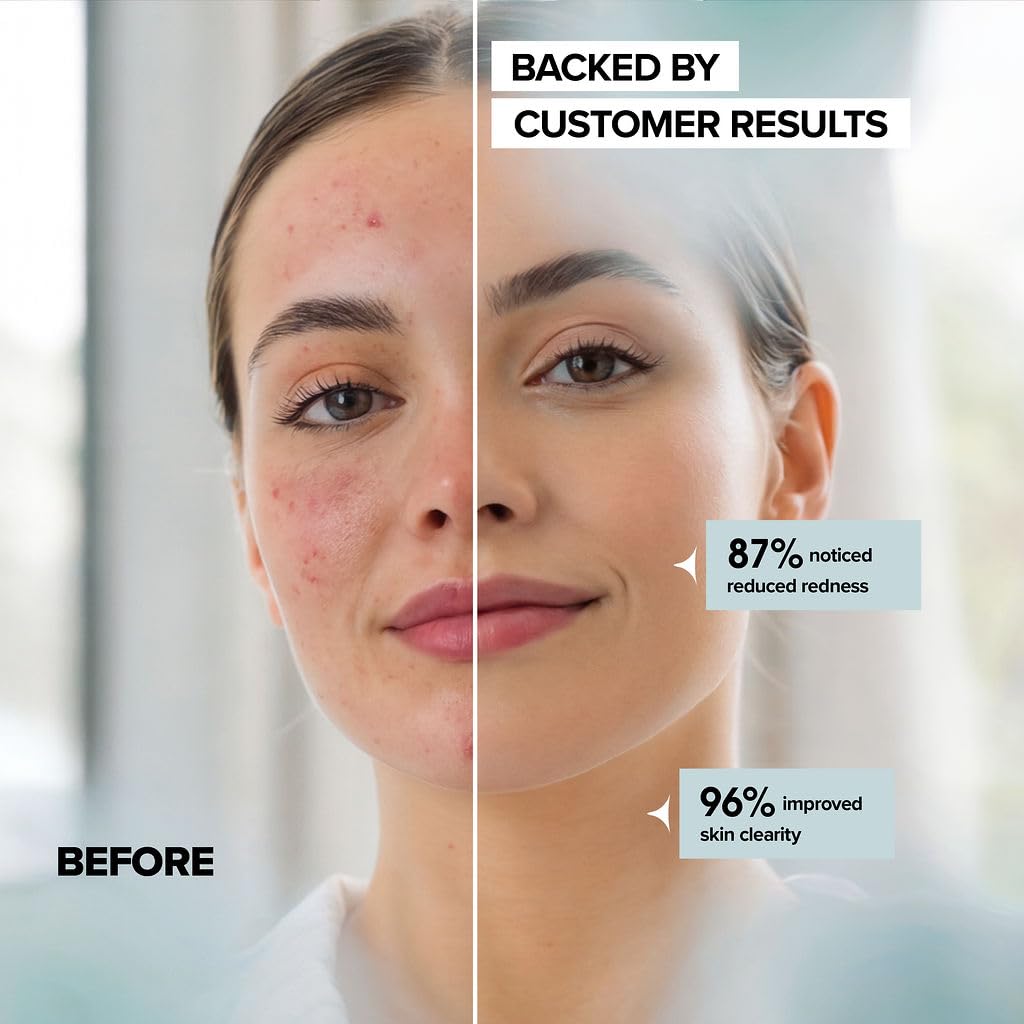 Ultra Soft Disposable Face Towels for Women – Biodegradable, Thick & Gentle on Sensitive Skin, 10x12 Cleansing & Makeup Removal, 50 Pack