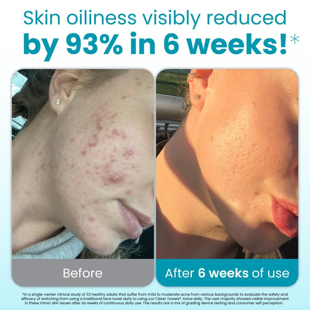 Clean Skin Club Blemish Control XL Towels® – Compostable Face Wipes for Oily & Sensitive Skin, Light Exfoliation, Makeup Removal, 50 Count