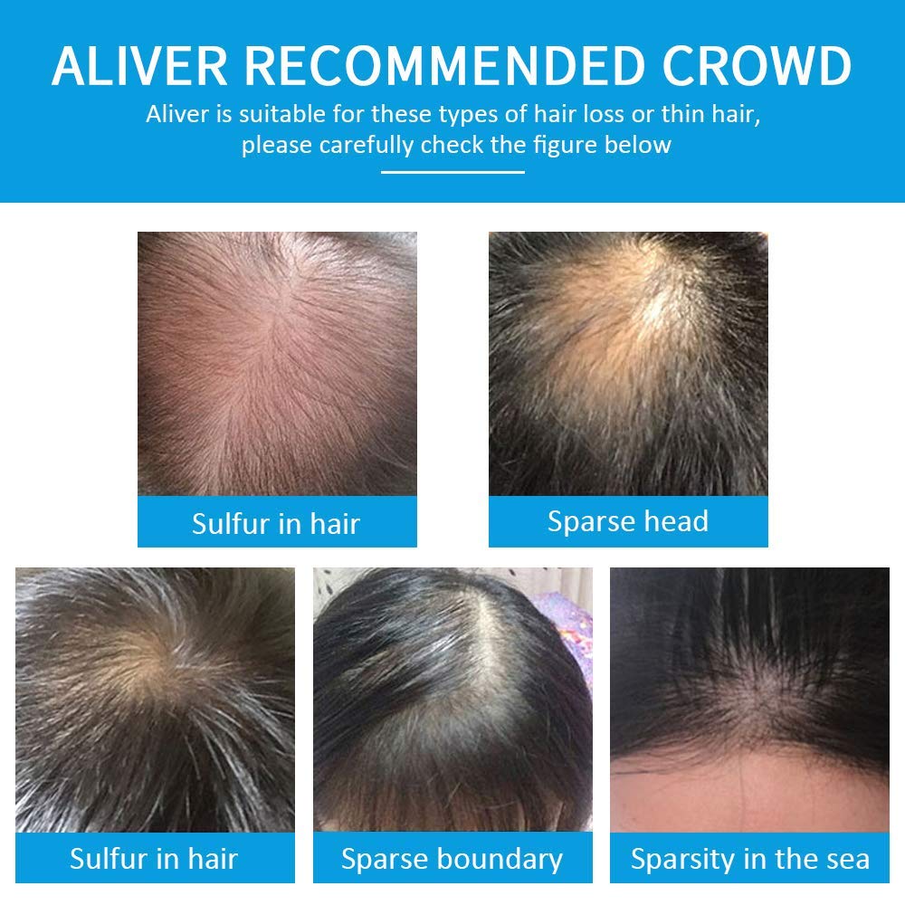 Aliver Hair Fibers for Thinning Hair Dark Brown – Instant Fuller, Thicker Look in 15 Secs – Conceals Hair Loss for Men & Women, 0.97 Oz