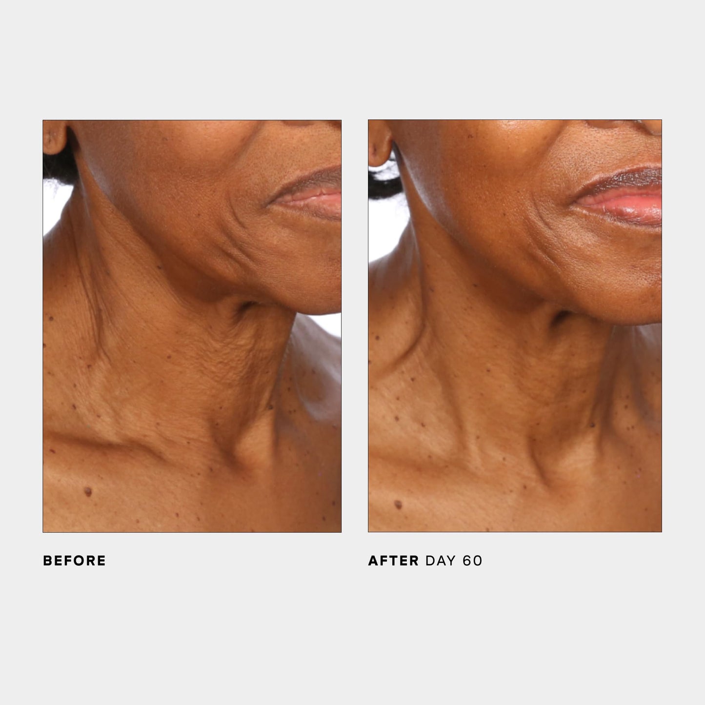 U Beauty The SCULPT Neck + Décolleté Concentrate