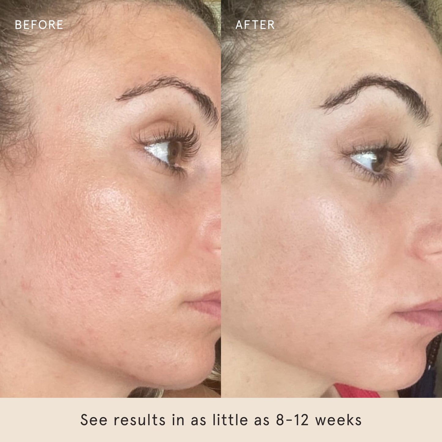 Barefaced Toning Pads 60ct – Exfoliating Face Pads with 2% Glycolic & Salicylic Acid to Brighten, Cleanse, Clear Pores & Reduce Fine Lines