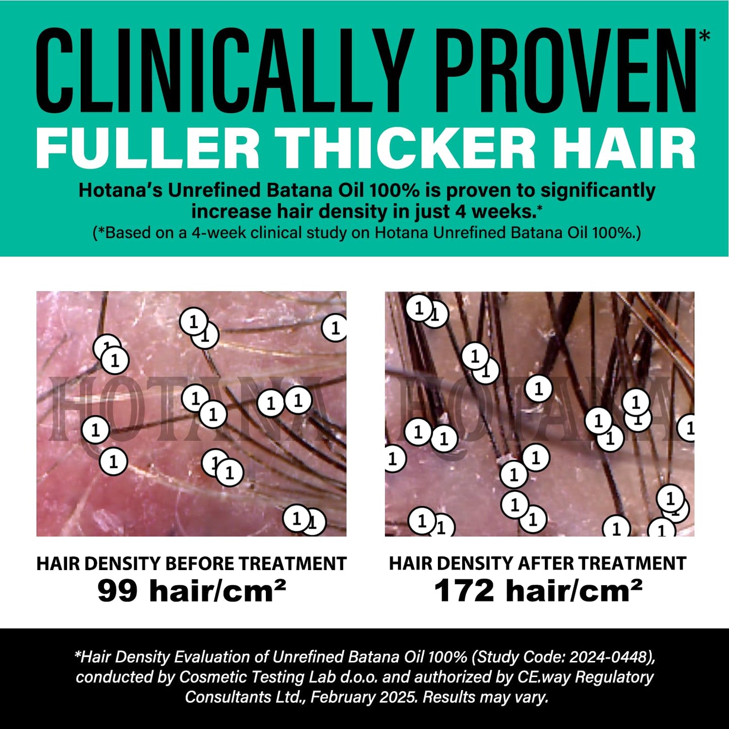 Unrefined Batana Oil for Hair Growth - Authentic & Organic Dr Sebi Batana Hair Mask from Honduras - Natural Hair Growth Oil - 4 Ounce Jar