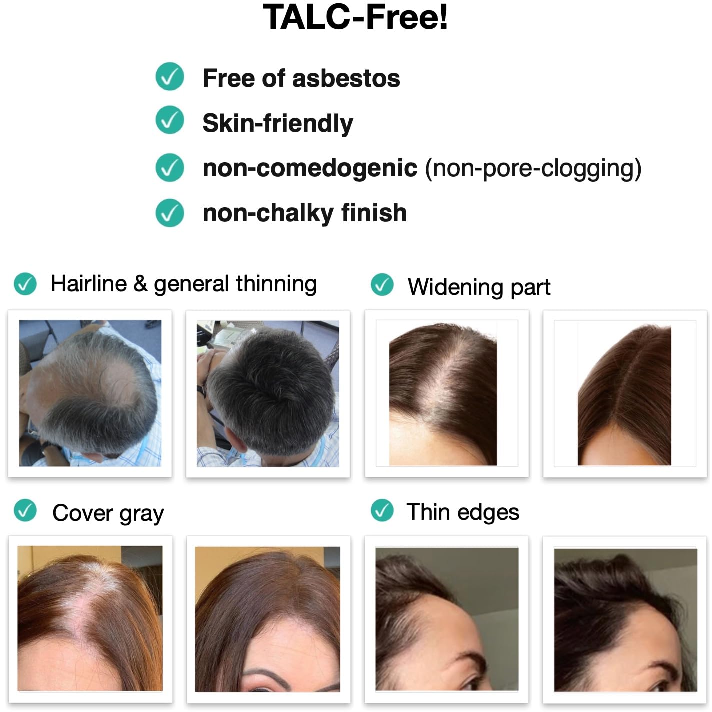 Caboki 10X Volumizing Hair Powder Dark Brown – Covers Bald Spots & Grays, Fills Hairline & Edges, Root Touch-Up for Thinning Hair, Talc-Free''[;[/