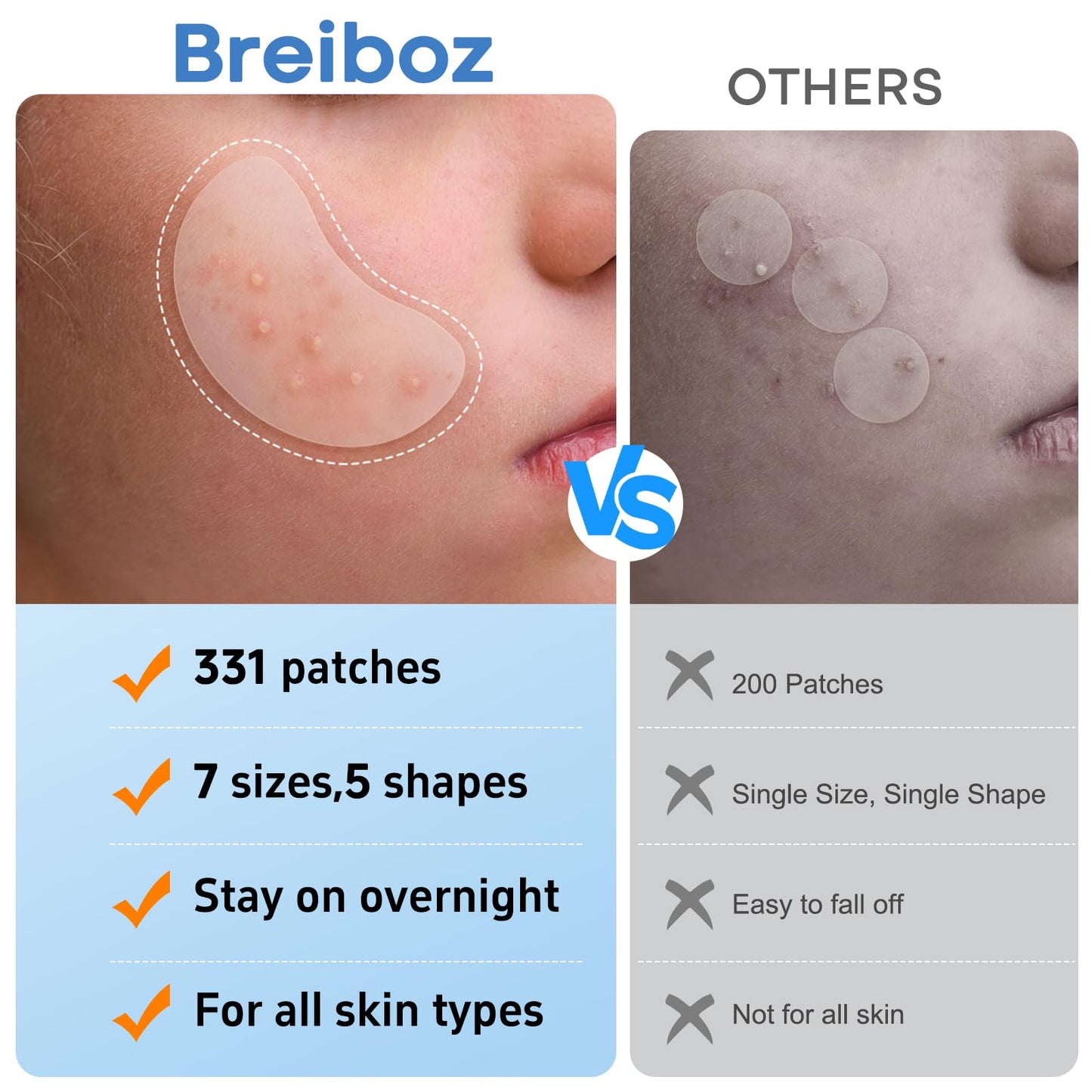 Large Acne Pimple Patches for Face – 331 Hydrocolloid Spots, 7 Sizes, Tea Tree, Salicylic Acid & Cica Oil, Big Spot Covers