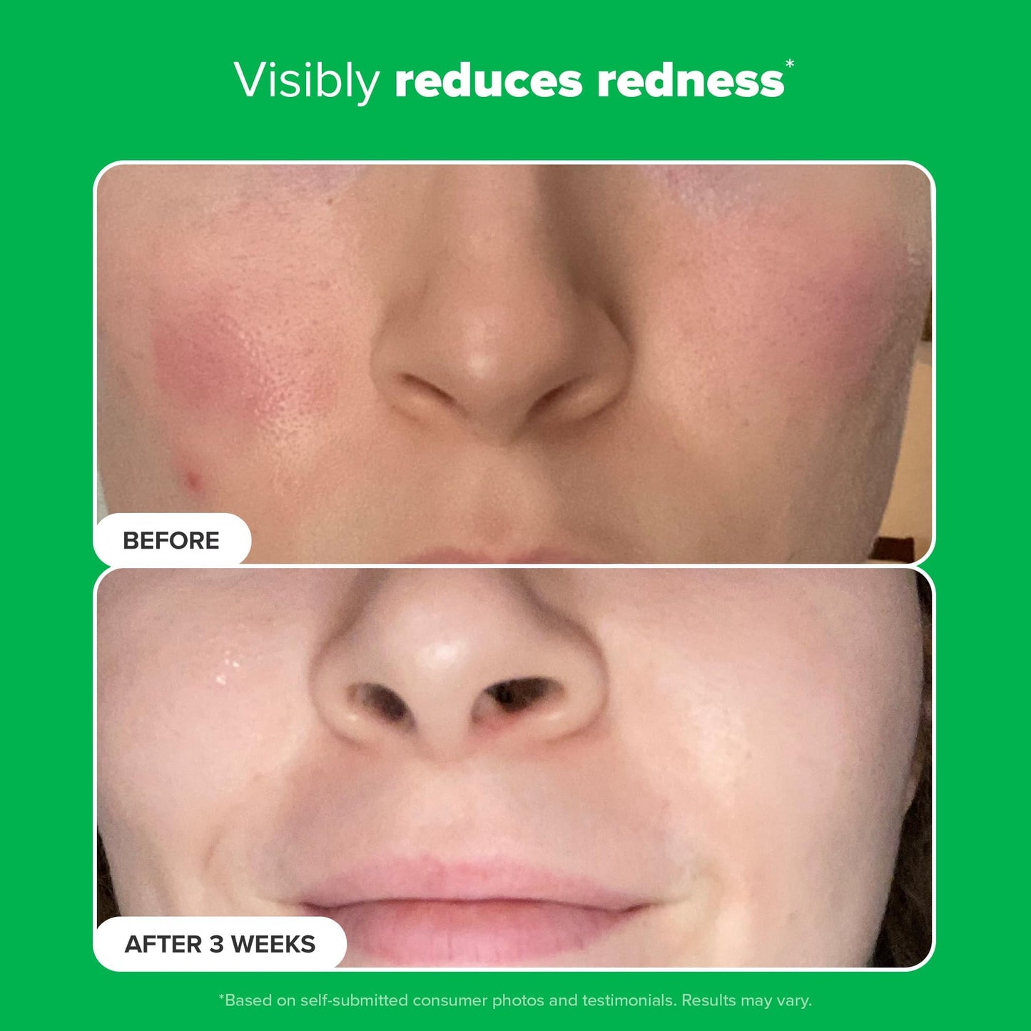 Paula's Choice BOOST 10% Azelaic Acid Booster Cream Gel Face Serum with Salicylic Acid, Oil-Free Skin Brightening Serum for Face, Fragrance-Free, 1oz