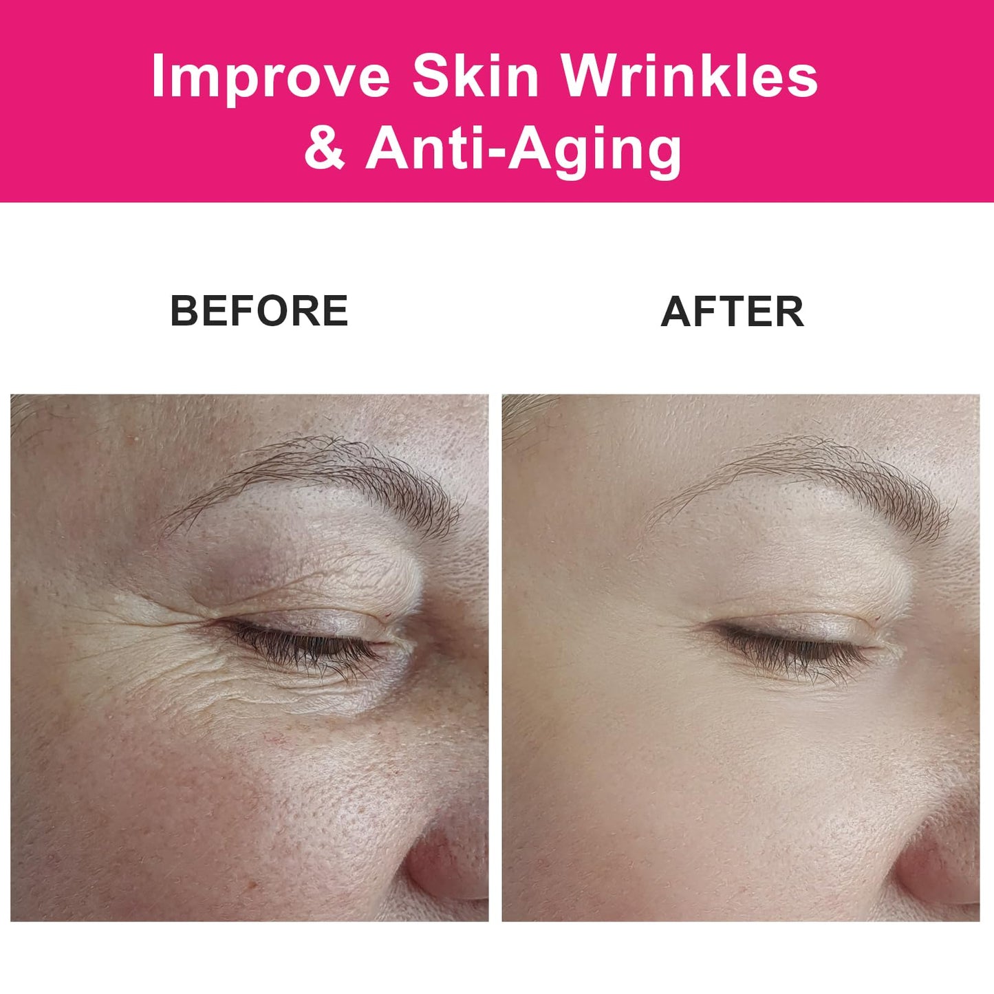 MMPANG Organic Rosehip Seed Oil for Face & Hair, USDA Certified, Cold-Pressed, 100% Pure, Anti-Aging, Acne Scar & Gua Sha Oil, 1oz