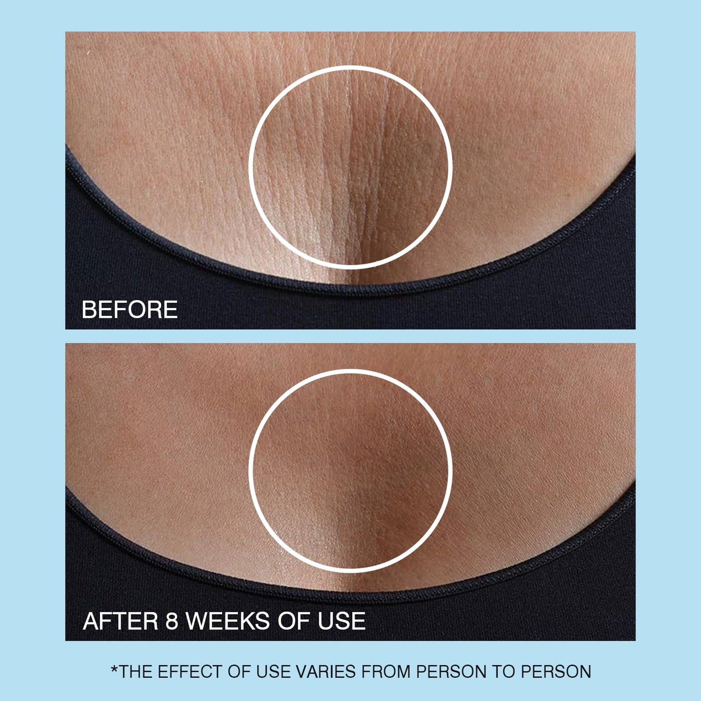 UJhay Retinol Neck Cream with Hyaluronic Acid & Caffeine – 3-in-1 Moisturizer for Neck, Chest & Face, Reduces Fine Lines & Dullness, 50ml