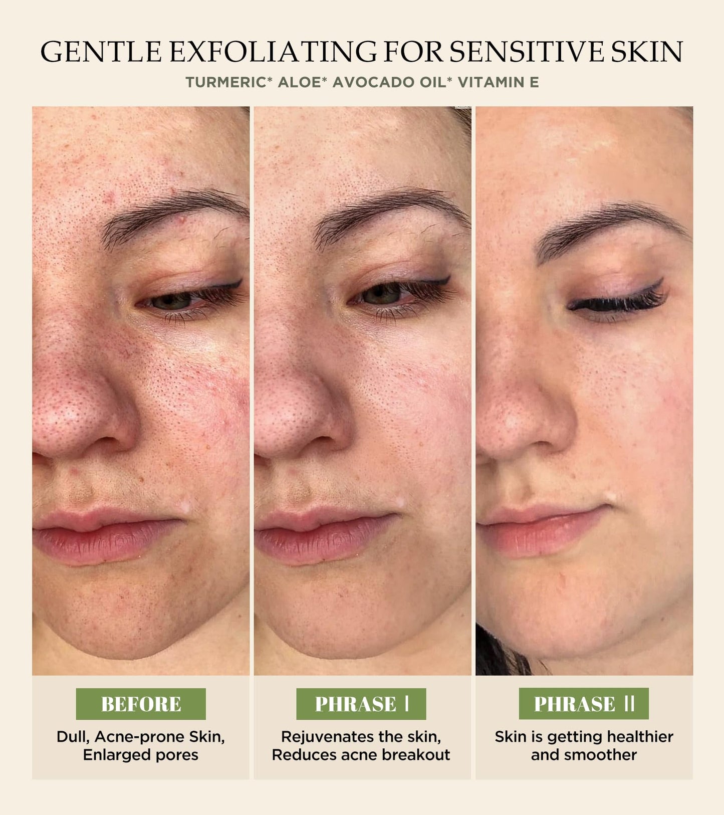 Vitamin C & Turmeric Face Scrub β Exfoliating Scrub for Face & Body, Anti-Aging, Clears Blackheads & Dark Spots, All Skin Types, 4.23 oz