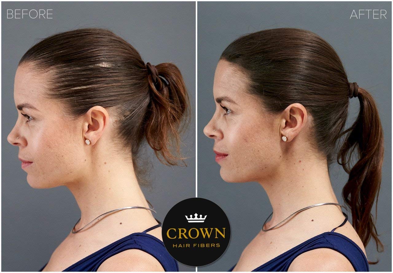 CROWN Hair Building Fibers 28g – Instantly Conceals Thinning Hair for Fuller, Thicker Look – Natural Keratin Hair Concealer for Men & Women, Black