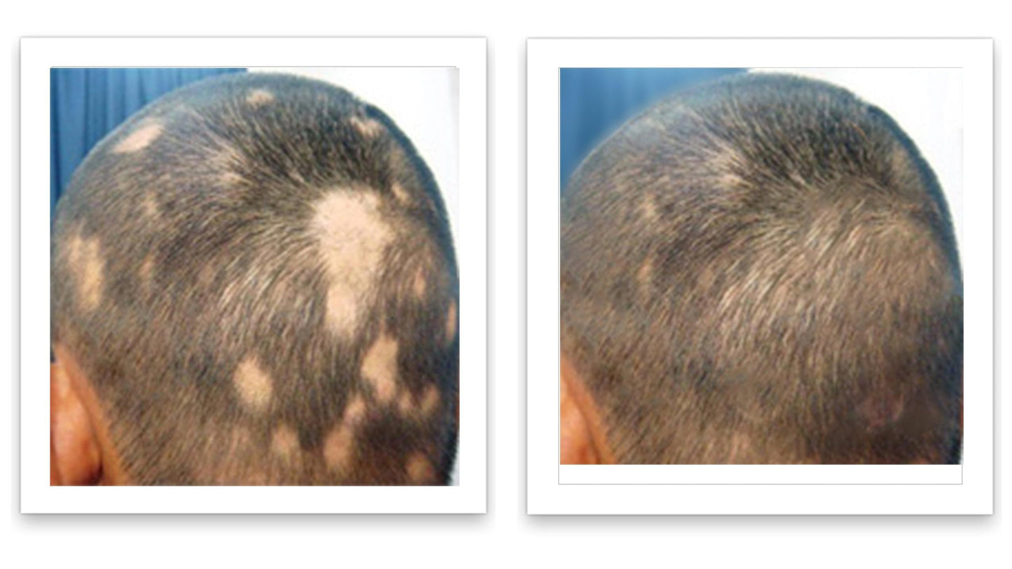 Caboki 10X Volumizing Hair Powder Dark Brown – Covers Bald Spots & Grays, Fills Hairline & Edges, Root Touch-Up for Thinning Hair, Talc-Free''[;[/