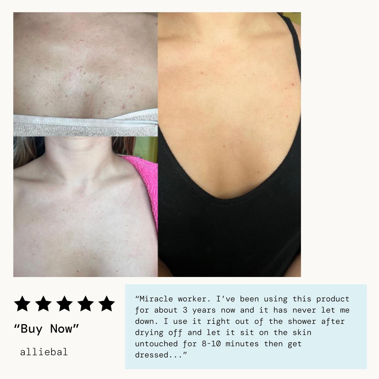 Pacifica Bacne Warrior Spray – 2% Salicylic Acid, Niacinamide & Aloe for Back, Chest & Body Acne – Dermatologist Tested, 6 Fl Oz