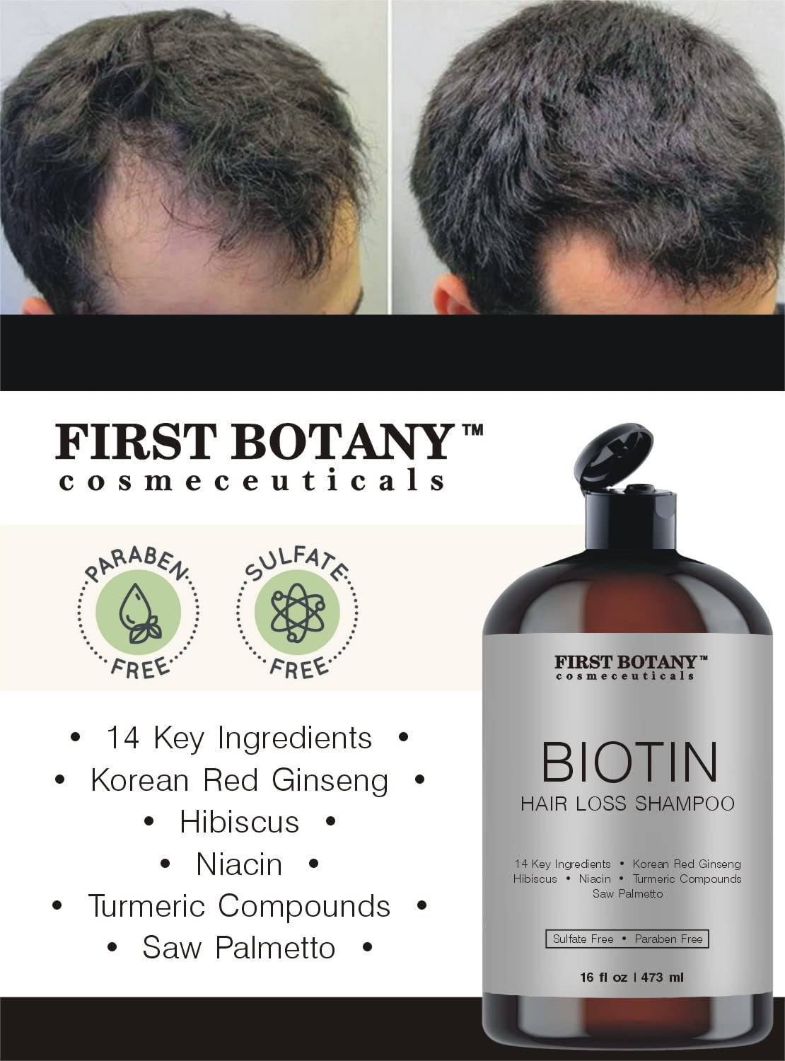 First Botany Hair Regrowth & Anti Hair Loss Shampoo 16 fl oz – DHT Blocker, Hydrating, Detoxifying & Volumizing Formula for Men & Women