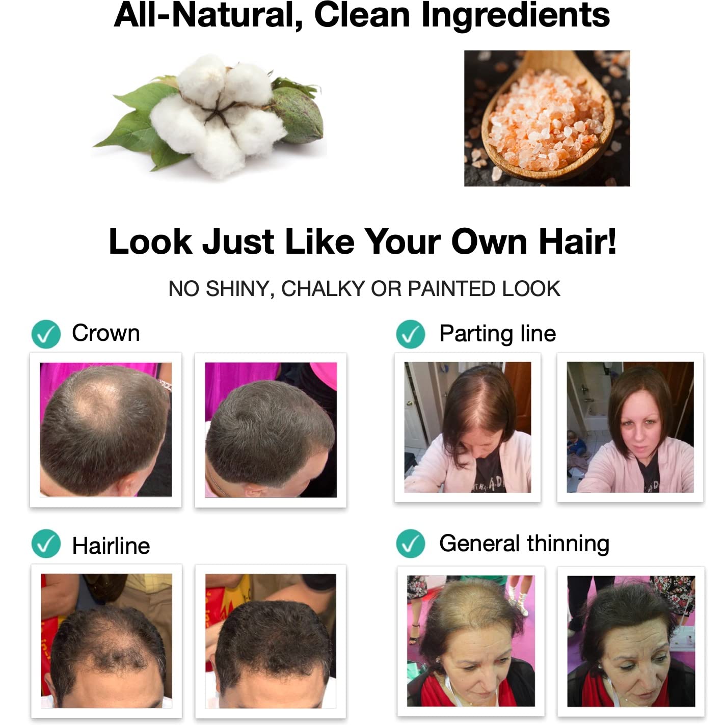 Caboki Hair Building Fiber 16G (Dark Brown)