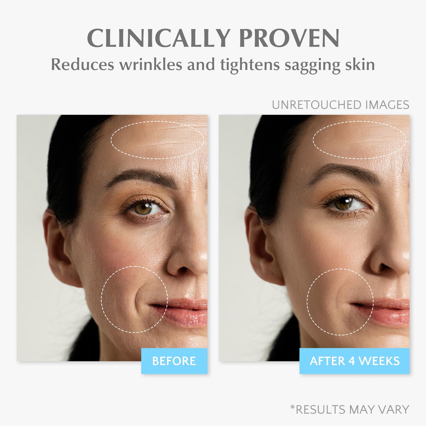 Retinol Anti-Aging Face Moisturizer for Women – Wrinkle Cream, Collagen Repair, Firming & Lifting Neck, 7% Hyaluronic Acid, 1.7 oz