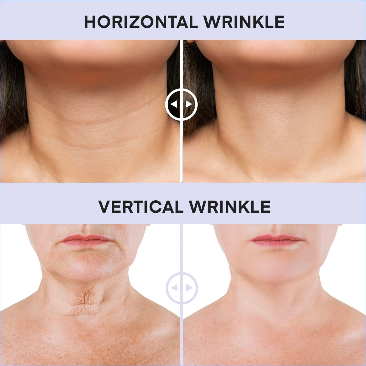 DERPHEA Neck & Decollete Firming Cream – Tightens Skin, Reduces Fine Lines, Firms Loose & Sagging Areas, 1.7 OZ