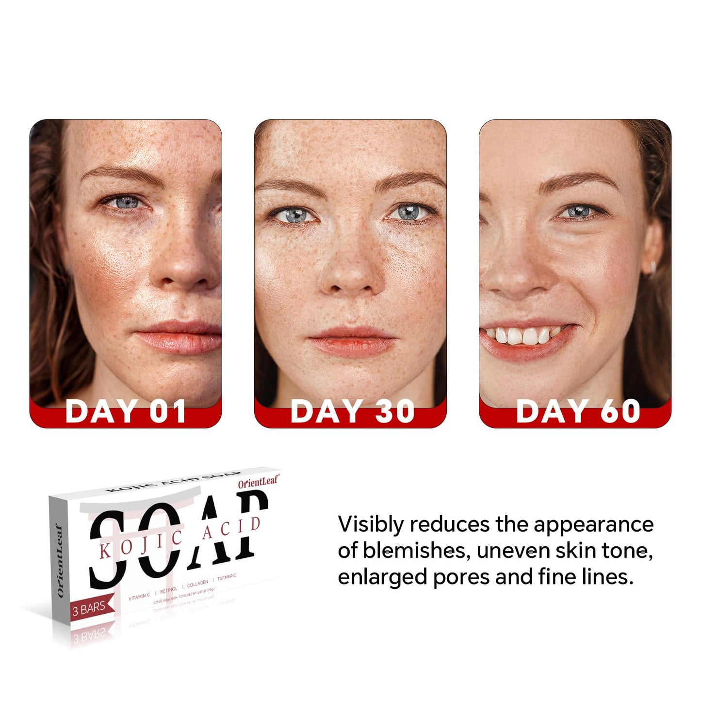 ORIENTLEAF Kojic Acid & Turmeric Soap 3-Pack – Brightening Bar for Dark Spots, Face & Body, Vitamin C, Shea Butter & Collagen