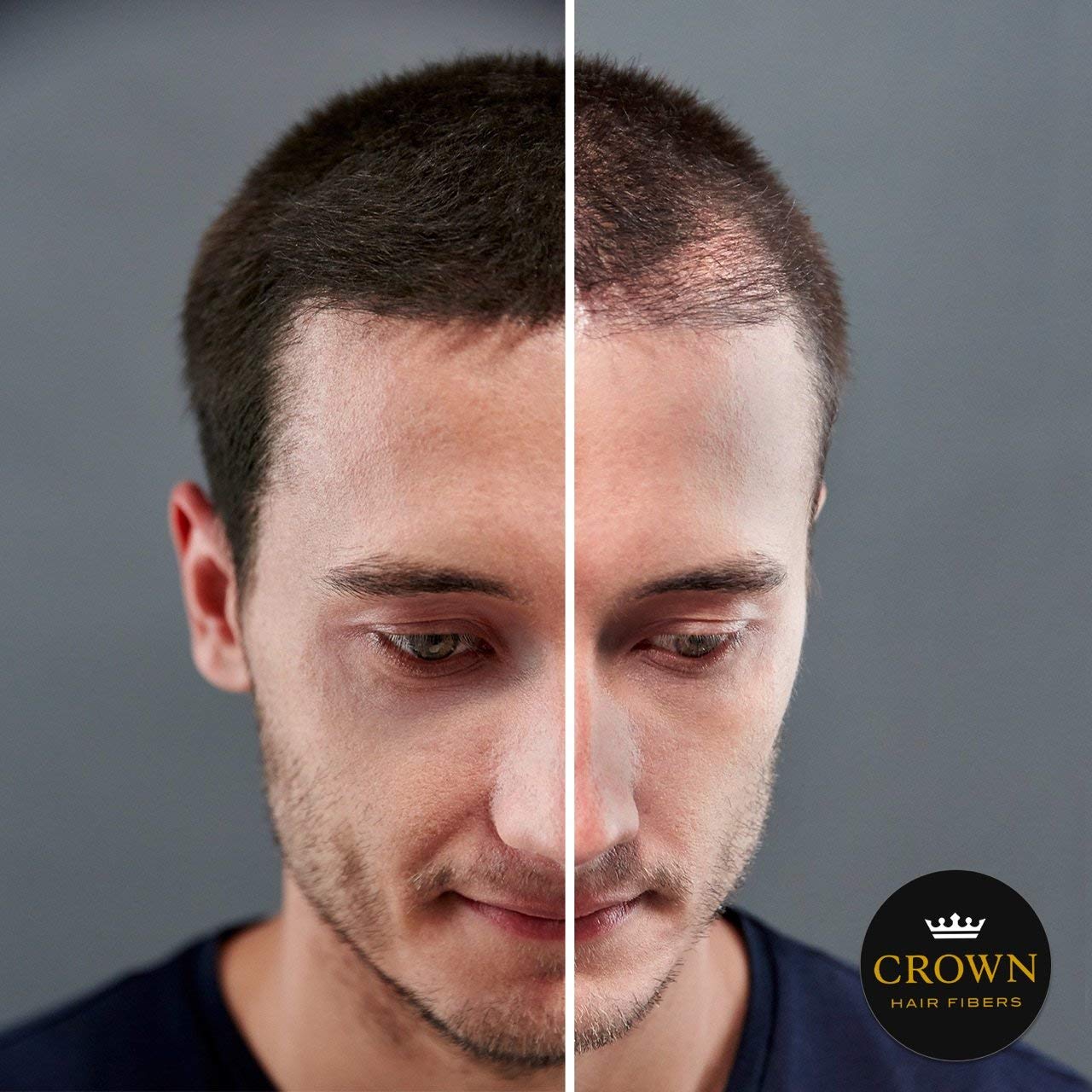 CROWN Hair Building Fibers 28g – Instantly Conceals Thinning Hair for Fuller, Thicker Look – Natural Keratin Hair Concealer for Men & Women, Black