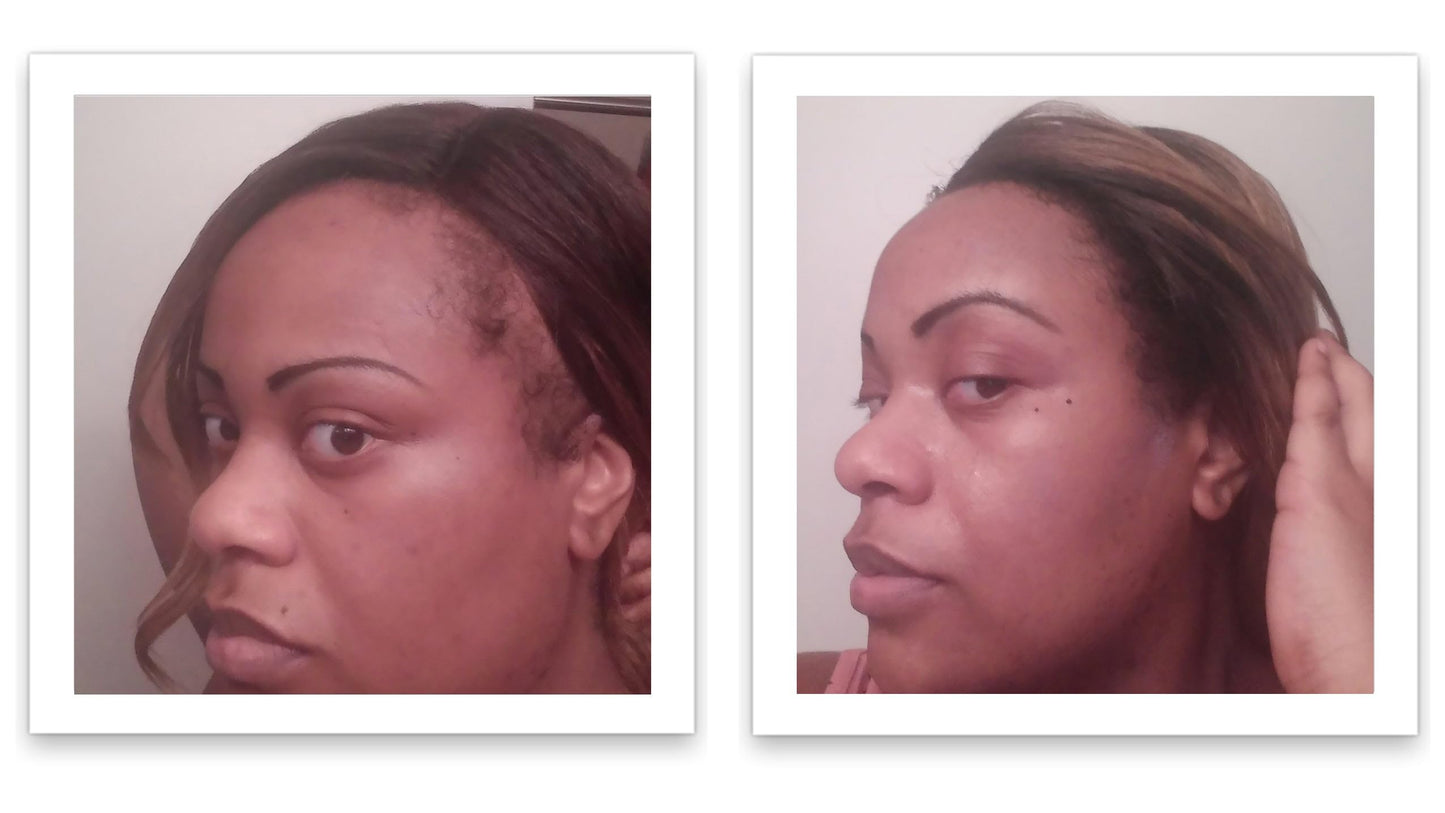 Caboki 10X Volumizing Hair Powder Dark Brown – Covers Bald Spots & Grays, Fills Hairline & Edges, Root Touch-Up for Thinning Hair, Talc-Free''[;[/