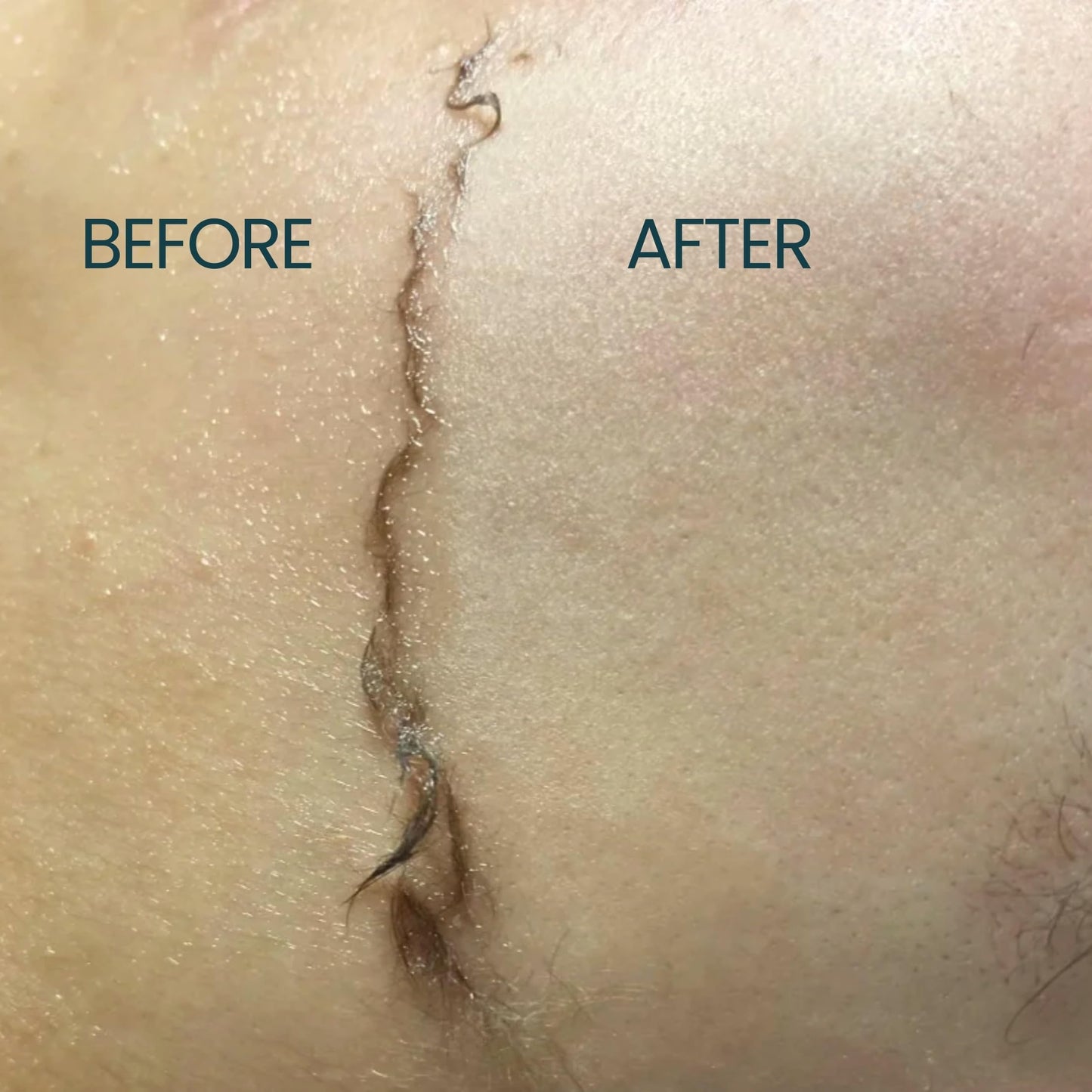 Dermaplane Face Shaving Oil for Women – Sensitive Skin, Non-Comedogenic, Fragrance-Free, Lightweight, Natural, 2oz by Ouiloe