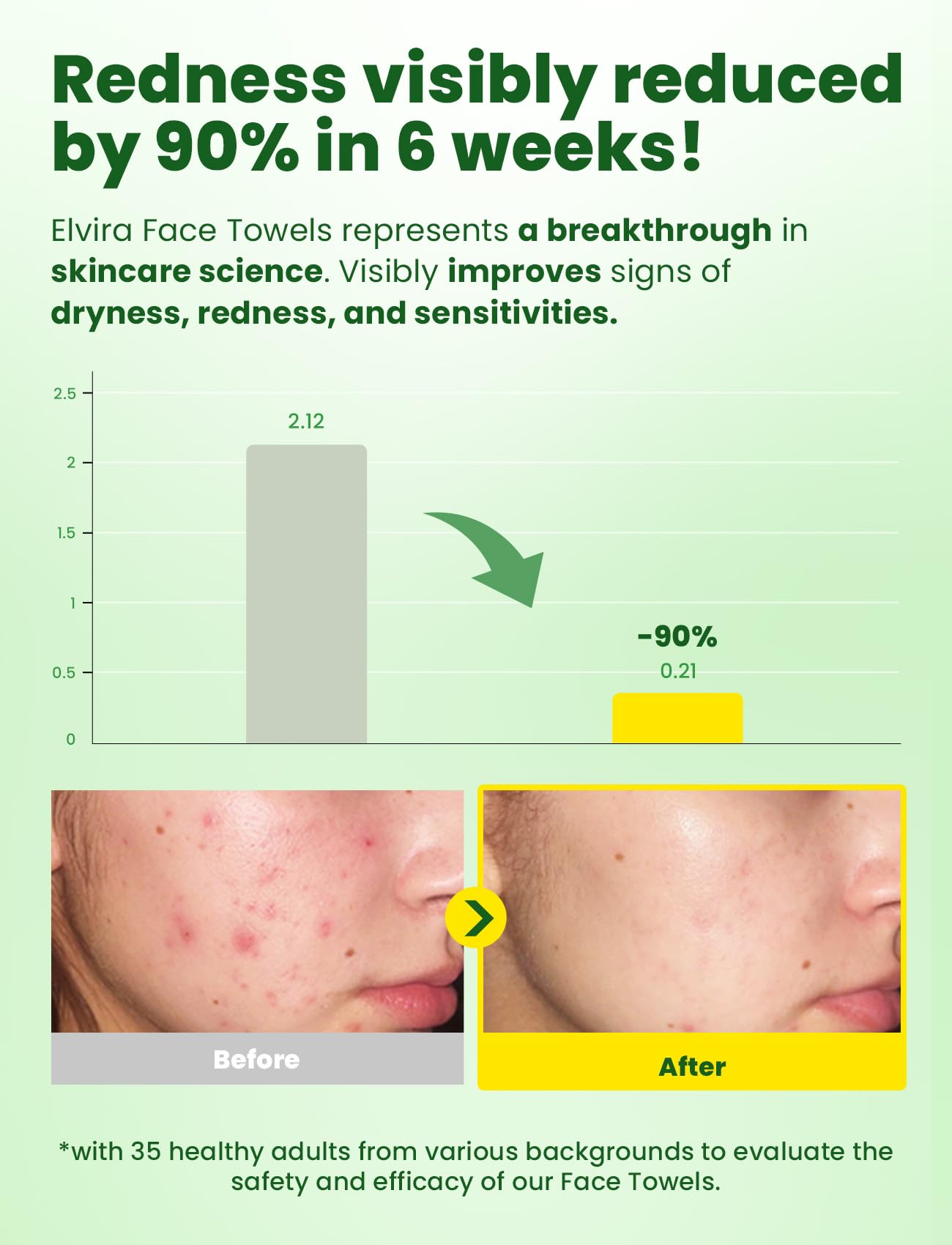 Elvira 100ct Biodegradable Disposable Face Towels – Ultra Soft, Thick, Lint-Free Cleansing Wipes for Sensitive Skin & Makeup Removal