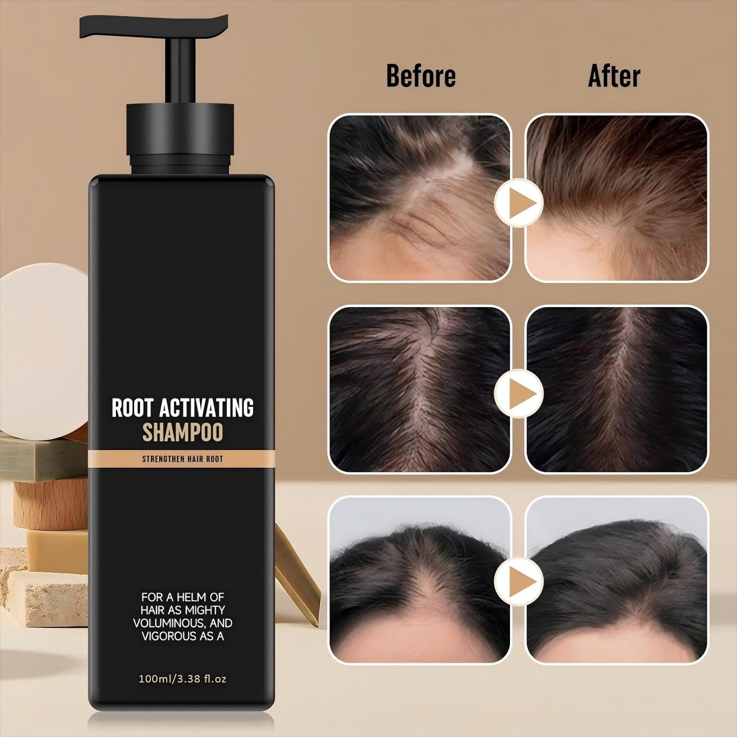 Root Activator Shampoo 2PCS – Anti Hair Loss & Shedding Treatment | Natural Regrowth Formula | Thickening, Nourishing & Smoothing for All Hair Types