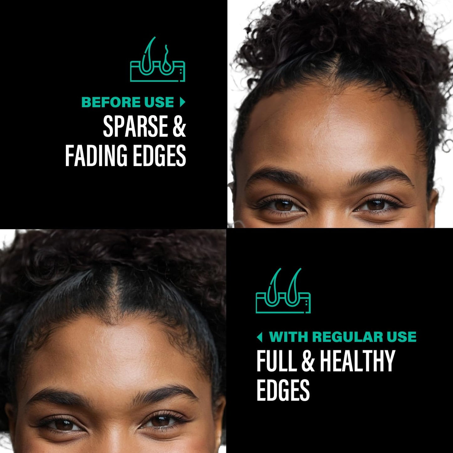 Unrefined Batana Oil for Hair Growth - Authentic & Organic Dr Sebi Batana Hair Mask from Honduras - Natural Hair Growth Oil - 4 Ounce Jar