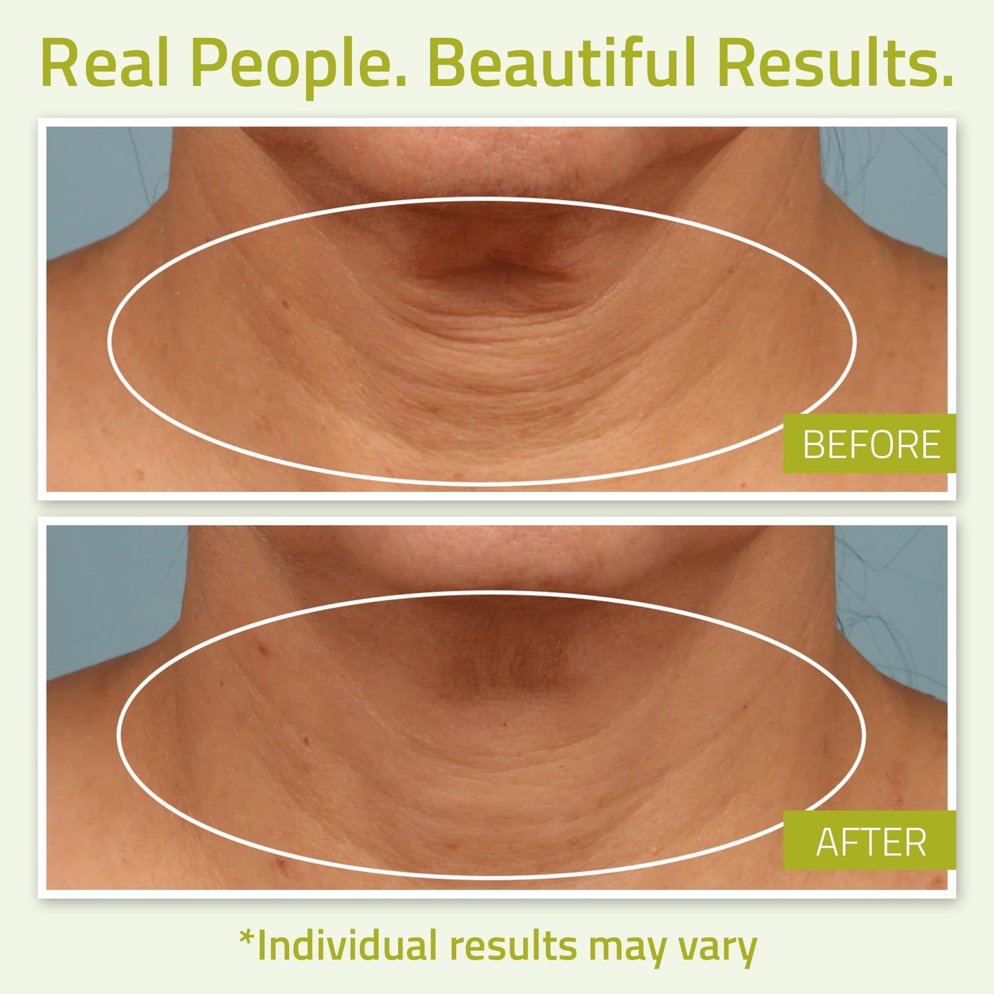 YEOUTH Neck Cream with Vitamin C – Firming Moisturizer for Face, Neck & Chest, Targets Double Chin & Décolletage, 2oz