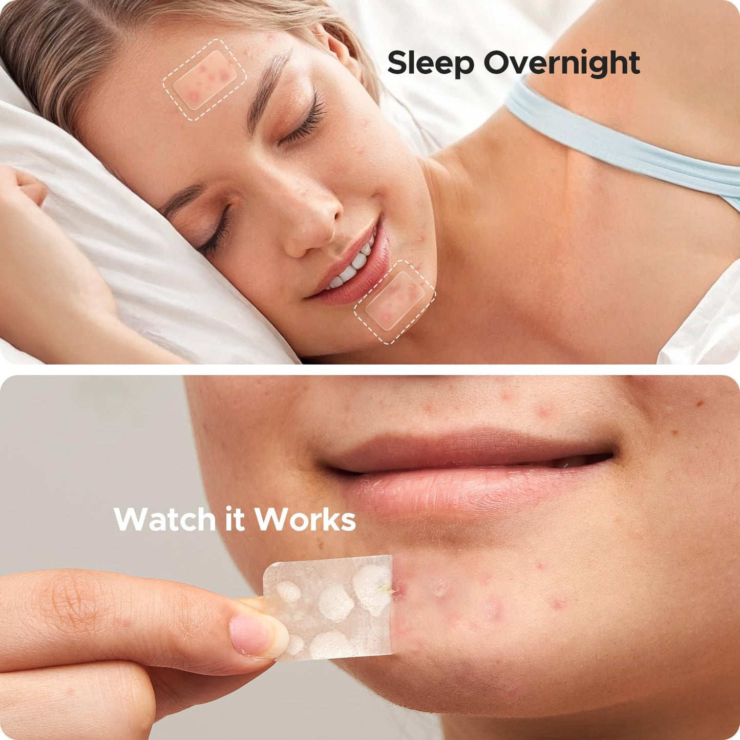 Large Pimple Patches for Face & Body – 7 Sizes XL Hydrocolloid Acne Bandages for Chin, Forehead, Nose, Back – 142 Count (Square, Strip, Dot)