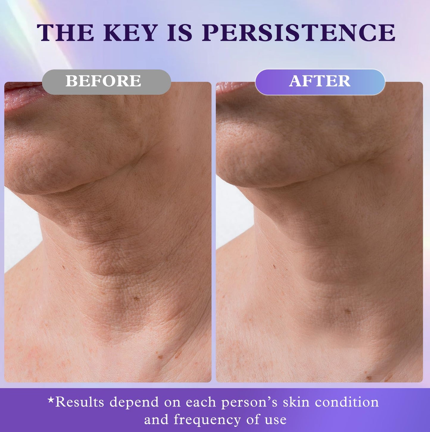 UKVOA Retinol Neck & Face Cream for Women – Anti-Aging, Firming & Tightening with Collagen & Hyaluronic Acid, 1.7 fl oz